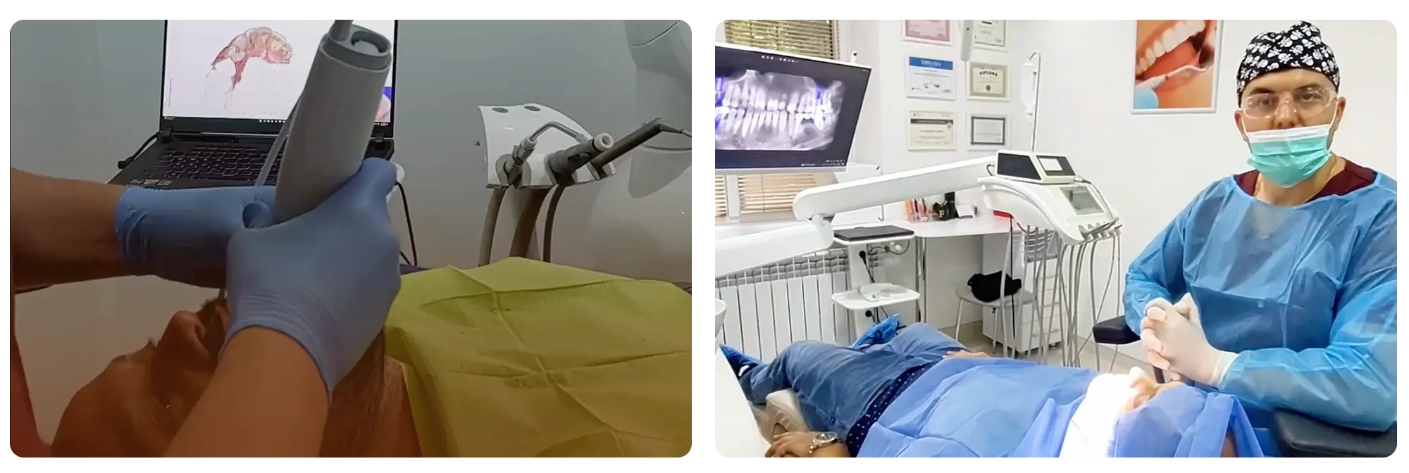 Implant Dentar 2